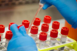 In this March 11 photo, a technician prepares COVID-19 coronavirus patient samples for testing at a laboratory in New York's Long Island. Wide-scale testing is a critical part of tracking and containing infectious diseases. But the U.S. effort has been plagued by a series of missteps, including accuracy problems with the test kits the CDC sent to other labs and bureaucratic hurdles that slowed the entrance of large, private sector labs.