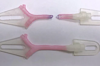 3D-printed models showing virtual surgical planning for a slide tracheoplasty procedure, courtesy Kaalan Johnson, M.D., Seattle Children's Hospital.