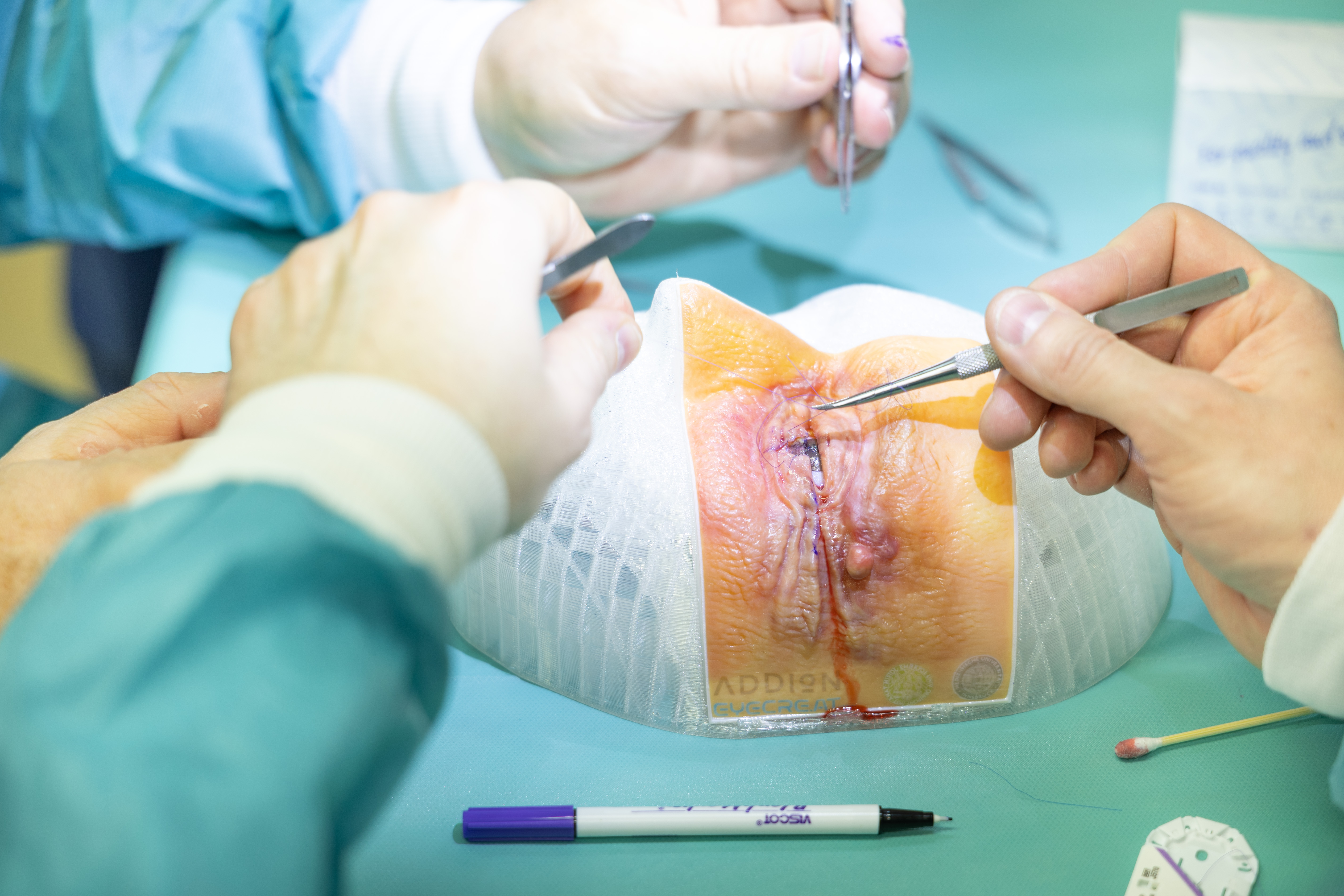 Addion Dap Eyelid Image 2